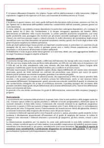 IL CARCINOMA DELLA PROSTATA