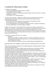 La malattia da reflusso gastro esofagea