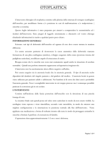 Otoplastica