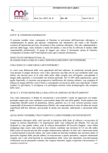 intervento di varici