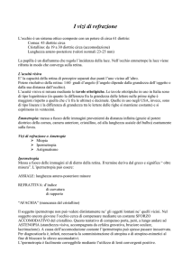I vizi di refrazione