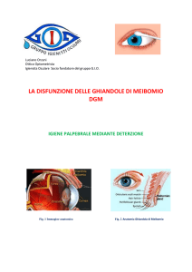 la disfunzione delle ghiandole di Meibomio ( DGM
