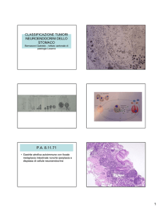 Classificazione tumori neuroendocrini dello stomaco