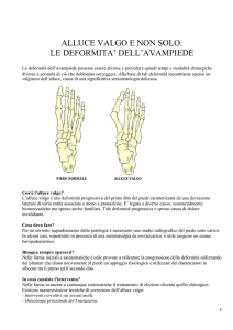 alluce valgo e non solo: le deformita` dell`avampiede