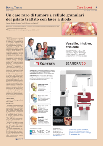 Un caso raro di tumore a cellule granulari del palato trattato con