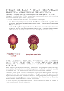 utilizzo del laser a tullio nell`iperplasia prostatica: vaporesezione