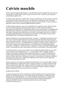 Calvizie maschile - Trattamento calvizie
