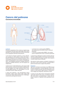 Cancro del polmone