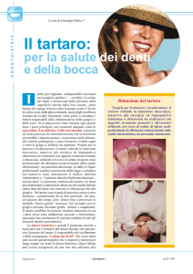 Il tartaro: la salute dei denti e della bocca