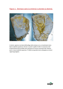 Figura 1. Stomaco sano (a sinistra) e ulcerato (a destra).