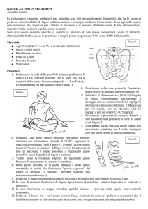 RACHICENTESI IN SEDAZIONE La rachicentesi o puntura