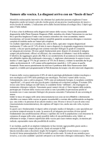 Tumore alla vescica. La diagnosi arriva con un “fascio di luce”