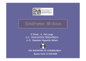 Sindrome di Moebius
