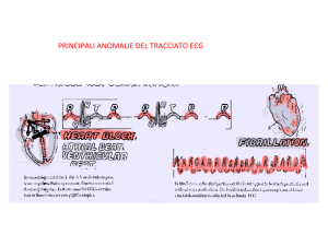 principali anomalie del tracciato ecg - Progetto e