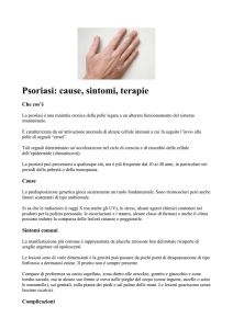 Psoriasi - Auxilium