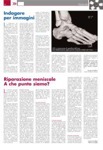 Riparazione meniscale A che punto siamo?