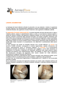 lesioni legamentose
