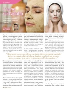 L`acne dell`adulto