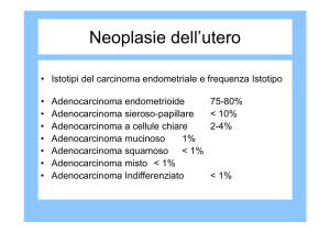 Neoplasie dell`utero