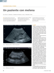 Un paziente con melena