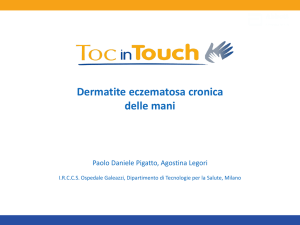 Dermatite eczematosa cronica delle mani