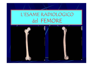 del FEMORE