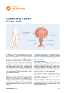 Cancro della vescica