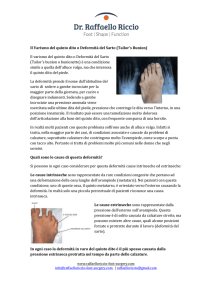 Il Varismo del quinto dito o Deformità del Sarto