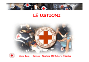 Ustioni - CRI Terni