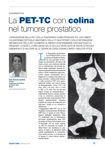 La PET-TC con colina nel tumore prostatico