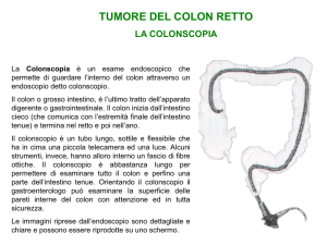 Colonscopia