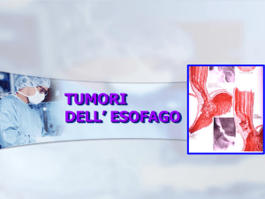 cancro dell` esofago