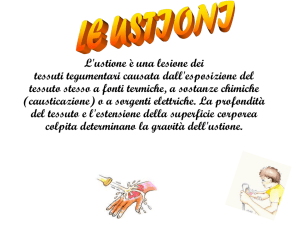 Le ustioni
