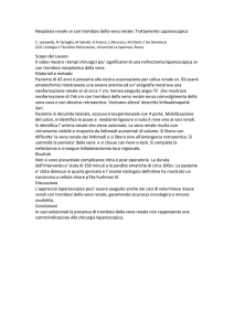 Neoplasia renale sn con trombosi della vena renale: Trattamento