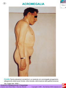 Acromegalia - Ateneonline