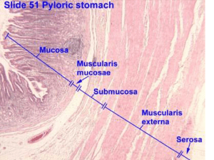 H. pylori