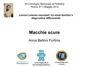 nevi melanocitici