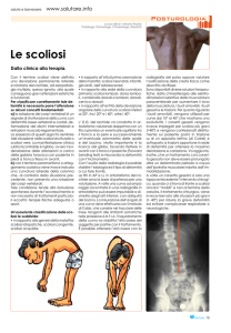Le scoliosi