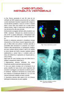 (Instabilità vertebrale.pub)