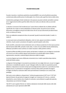 Pucker retinico - Centro Oculistico G. Perone, Specialisti in