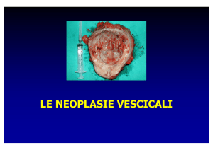 Il Carcinoma della vescica