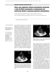 Vena cava superiore sinistra persistente associata a rete di Chiari