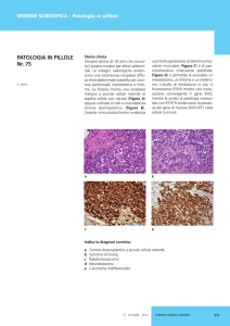 Leoni S, Tumore desmoplastico a piccole cellule rotonde intra