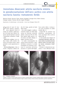 Aneurisma dissecante arteria succlavia sinistra in