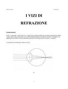 I vizi di refrazione