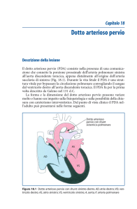 Dotto arterioso pervio