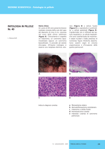 Mazzucchelli L,Fibroxantoma atipico, luglio/agosto 2009.
