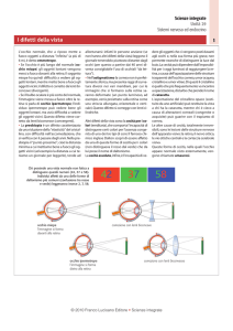 I difetti della vista - Zanichelli online per la scuola