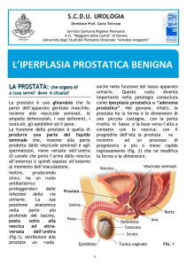 L`iperplasia prostatica benigna