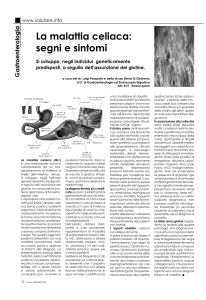 La malattia celiaca: segni e sintomi